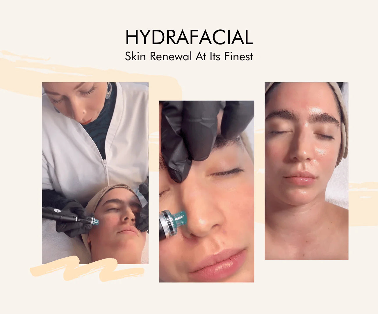 Unveiling the wonders of Hydrafacial - Skin Renewal at its finest