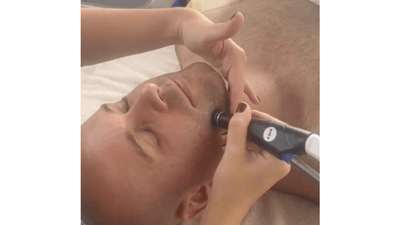Why Your Skin Is Begging for a Hydrafacial This Winter