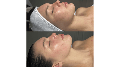 Buccal Massage at Victoria Roggio Beauty