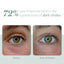EYE Serum