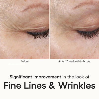 INTENSE Serum