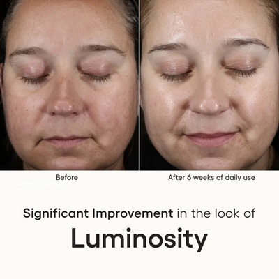 INTENSE Serum
