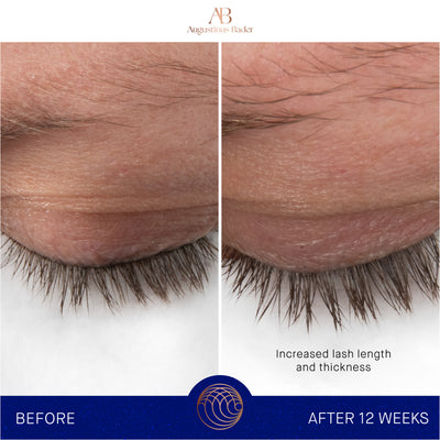 The Eyebrow and Lash Enhancing Serum